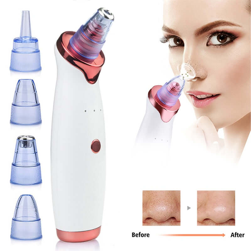 blackhead remover vacuum multiple interchangeable suction heads for targeted facial cleansing